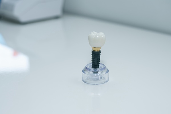 Things You Should Know Before Getting Dental Implants