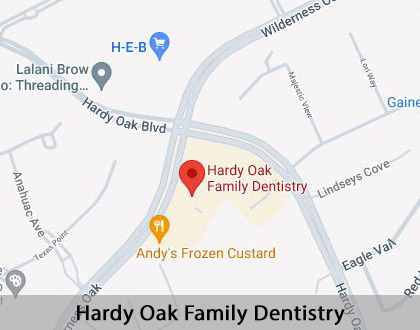 Map image for Cosmetic Dental Services in San Antonio, TX