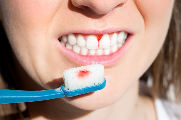 Benefits Of Gum Disease Treatment From A Dentist