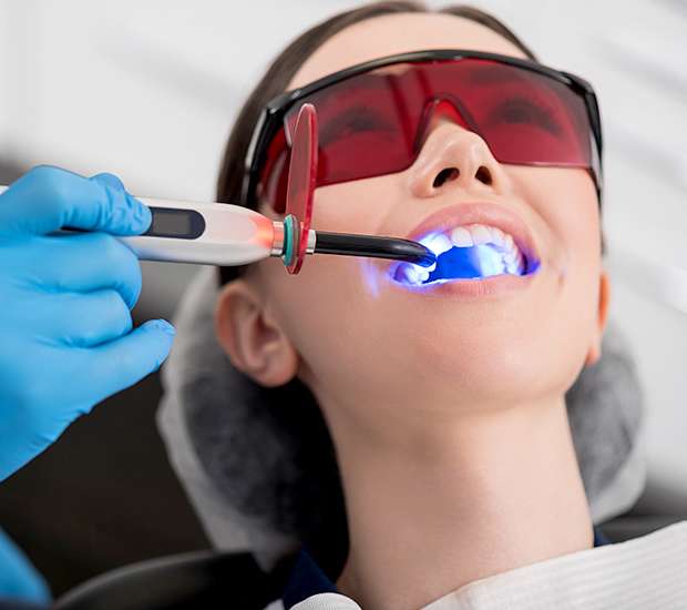 San Antonio Professional Teeth Whitening